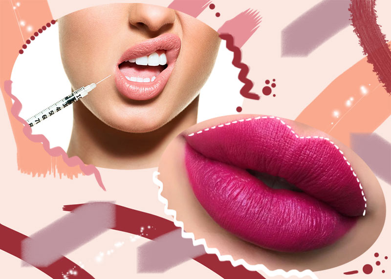 Lip Fillers Guide: Type of Lip Injections, Costs, and Side Effects