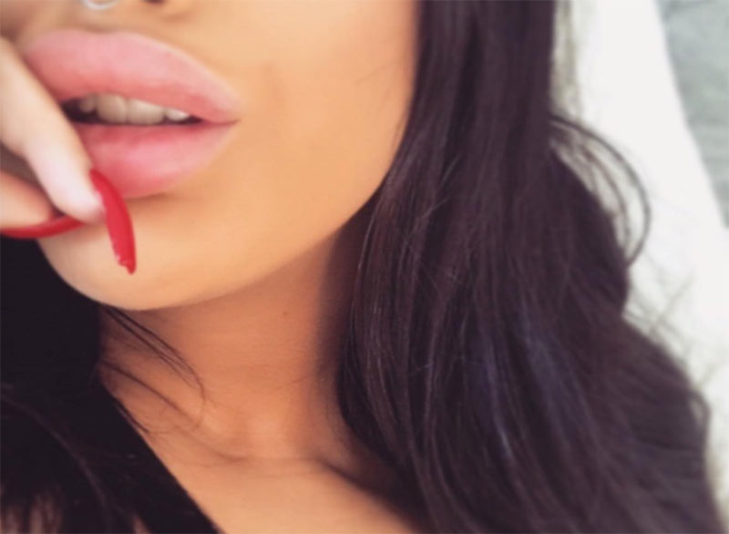 Types of Lip Fillers: Lip Injections Guide