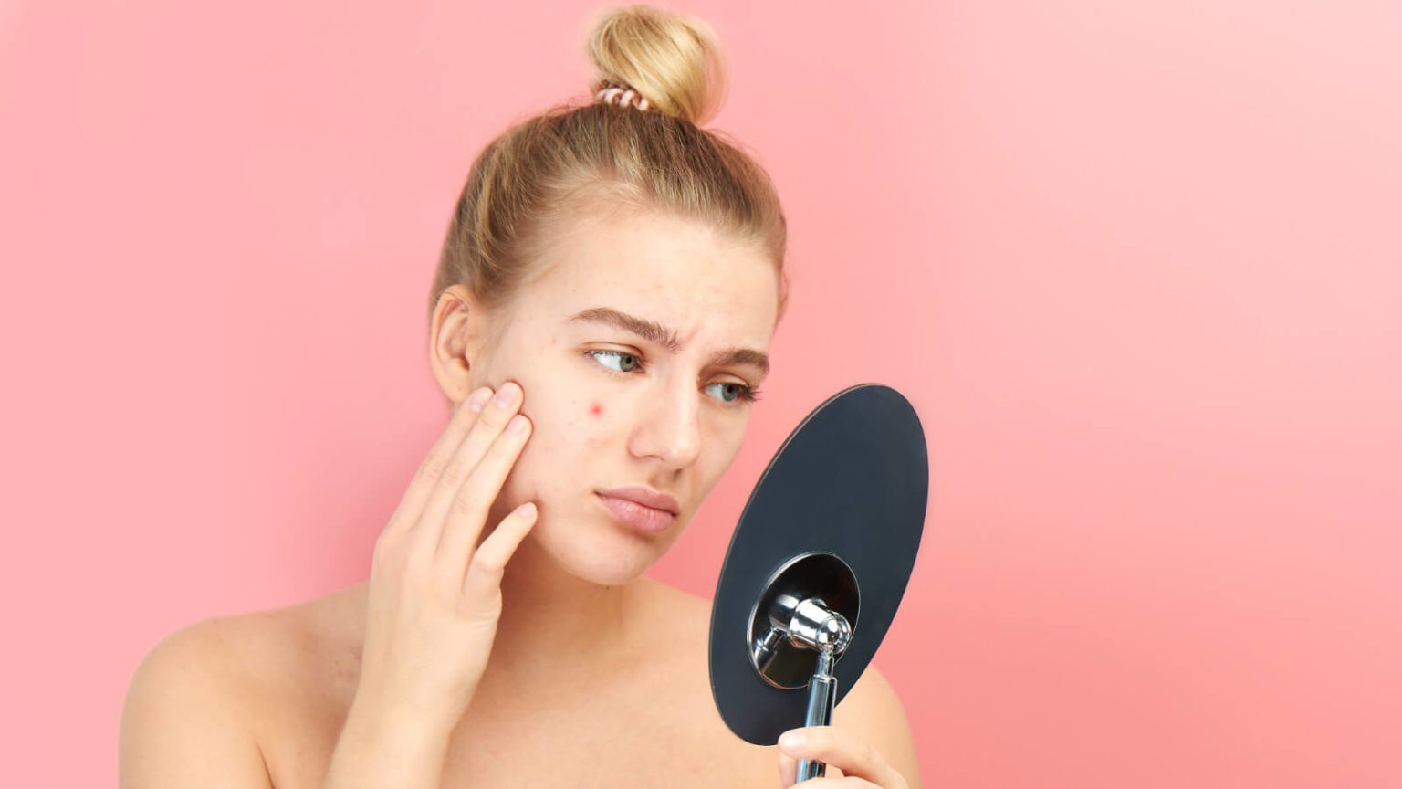 Hormonal Acne What It Is and How To Treat It Glowsly