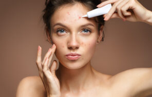 Unmasking Acne: Understanding Causes and Finding Effective Treatments